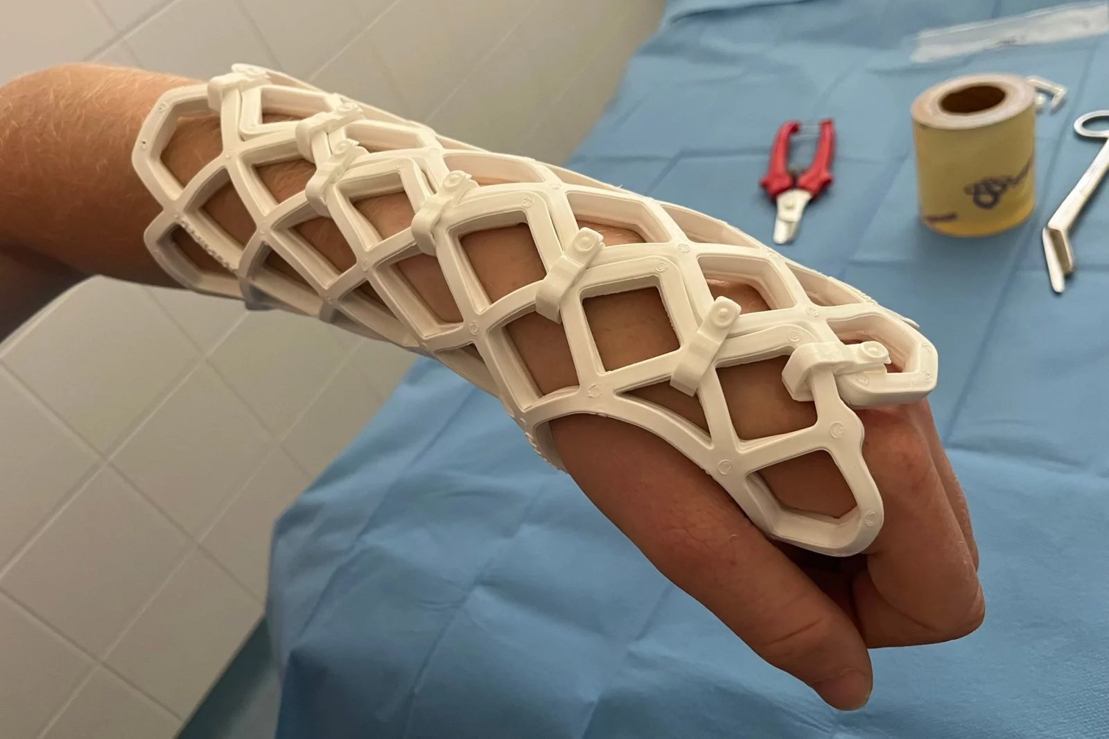 Vypadá jako z 3D tiskárny, ve skutečnosti je nová fixace zdravotnickým prostředkem v podobě karbonového výlisku vypodloženého měkkou pěnou.