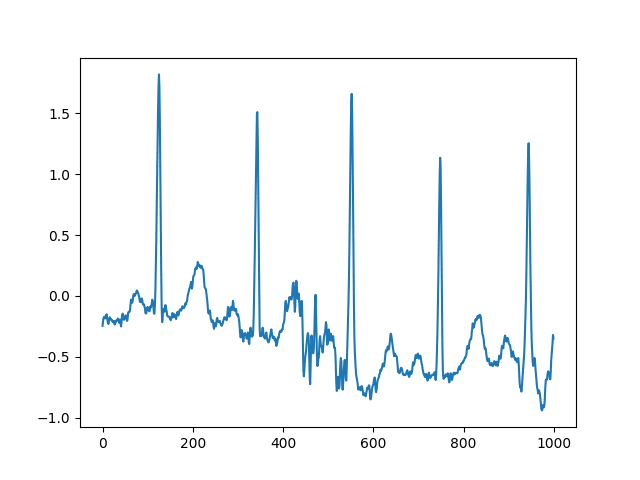 EKG, prvních 1000 vzorků