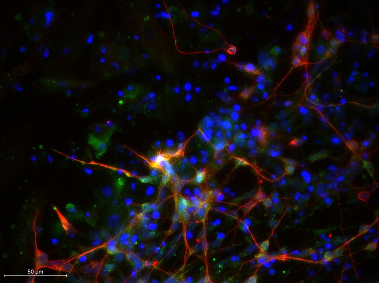 Fluorescenční mikrofotografie lidských neuronů s červenými výběžky, zelenými buňkami a modrými jádry.