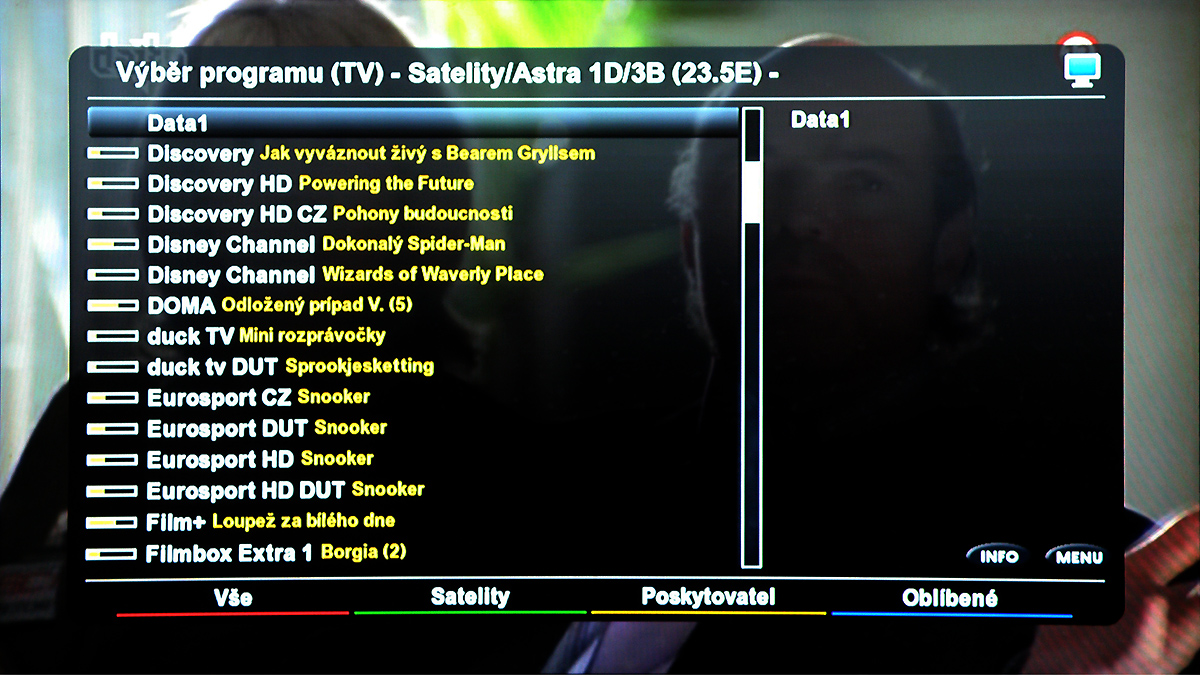 Show Box Vitamin HD 5000