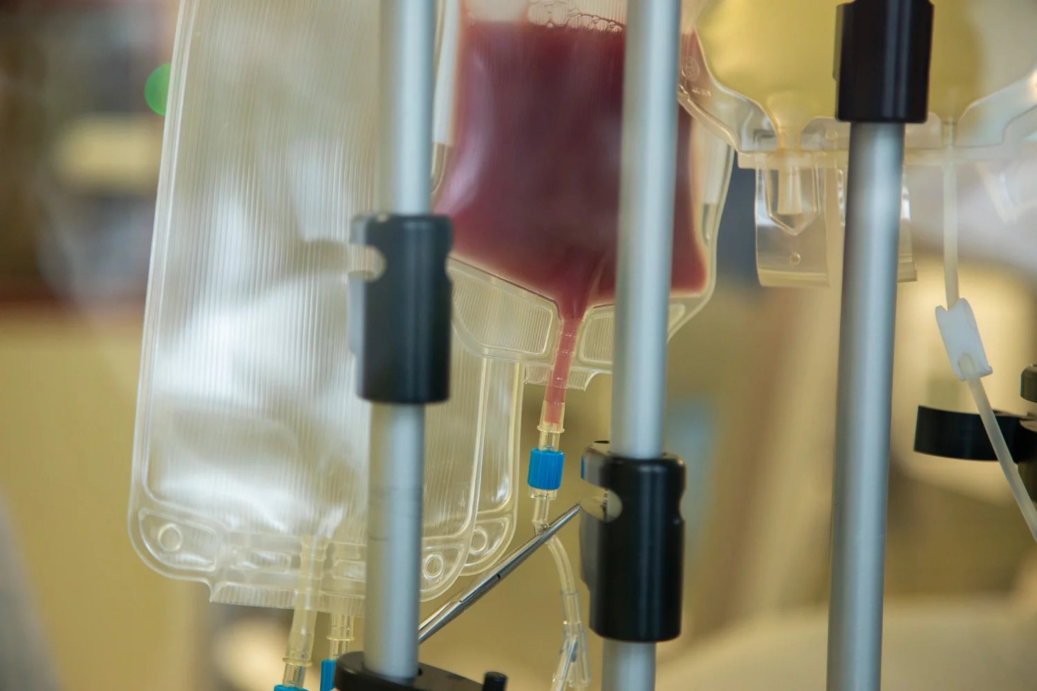 Vak s tmavě červenou barvou přicestoval do Prahy z USA od pacienta, kterého lékaři zařadili do klinické studie k buněčné terapii BOXR. Pacient trpí konkrétní formou rakoviny plic.
