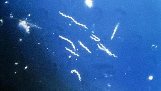 Náhledový obrázek - Jihočeští hygienici zjistili nejvíce lymeské borreliózy za 10 let