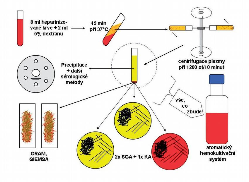 Obr. 7 – Postup zpracování heparinizované krve v mykologické laboratoři