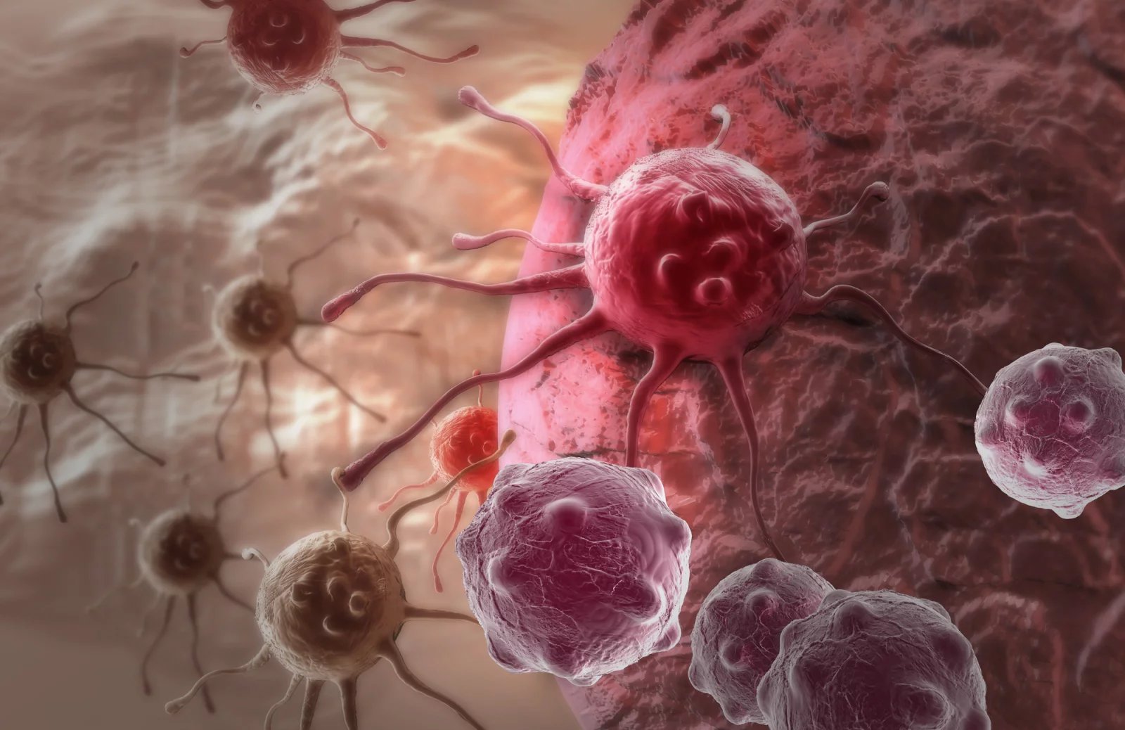 Maligní nádory je potřeba dále důkladně vyšetřit, a to kvůli jejich velikosti a případným metastázím. Mezi tato vyšetření spadají kupříkladu rentgenové snímky, krevní testy nebo CT.
