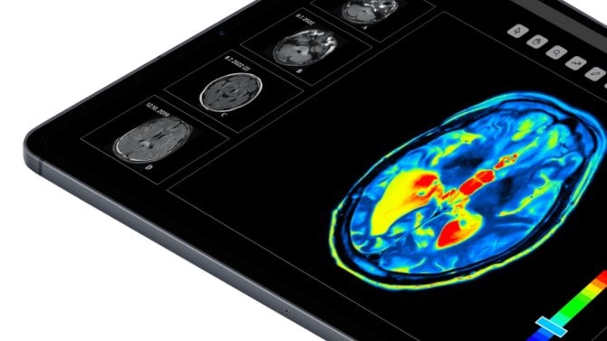 Český medicínský startup má klinicky ověřenou funkčnost algoritmů hledajících Alzheimerovu nemoc