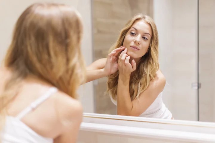 Akné (acne vulgaris) je onemocnění vlasových folikulů tváře, hrudníku a zad. Rozvíjí se vlivem zvýšené produkce mazových žláz a rozlišujeme tři formy nemoci: mírnou, středně těžkou a nejtěžší.