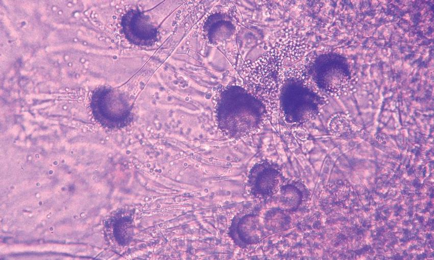 Obr. 3 – Aspergillus fumigatus v kultuře, obraz v optickém mikroskopu