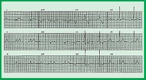 31bp-orig