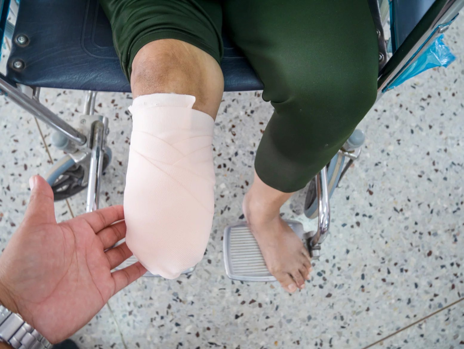 Toxiny, které bakterie sněti produkují, jsou životu nebezpečné. Gangréna je velmi vážný stav, který má na svědomí vznik velkých oblastí jizev a často také vyžaduje rekonstrukční chirurgii.