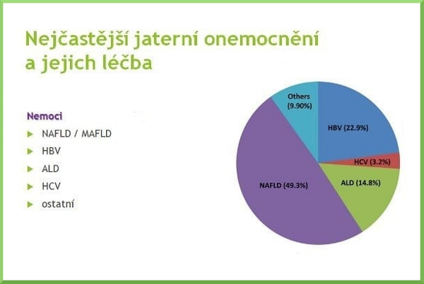 Vysvětlivky zkratek:
NAFLD / MAFLD - metabolická tuková choroba jater, HBV - hepatitida B, ALD - onemocnění jater související s alkoholem, HCV - hepatitida C