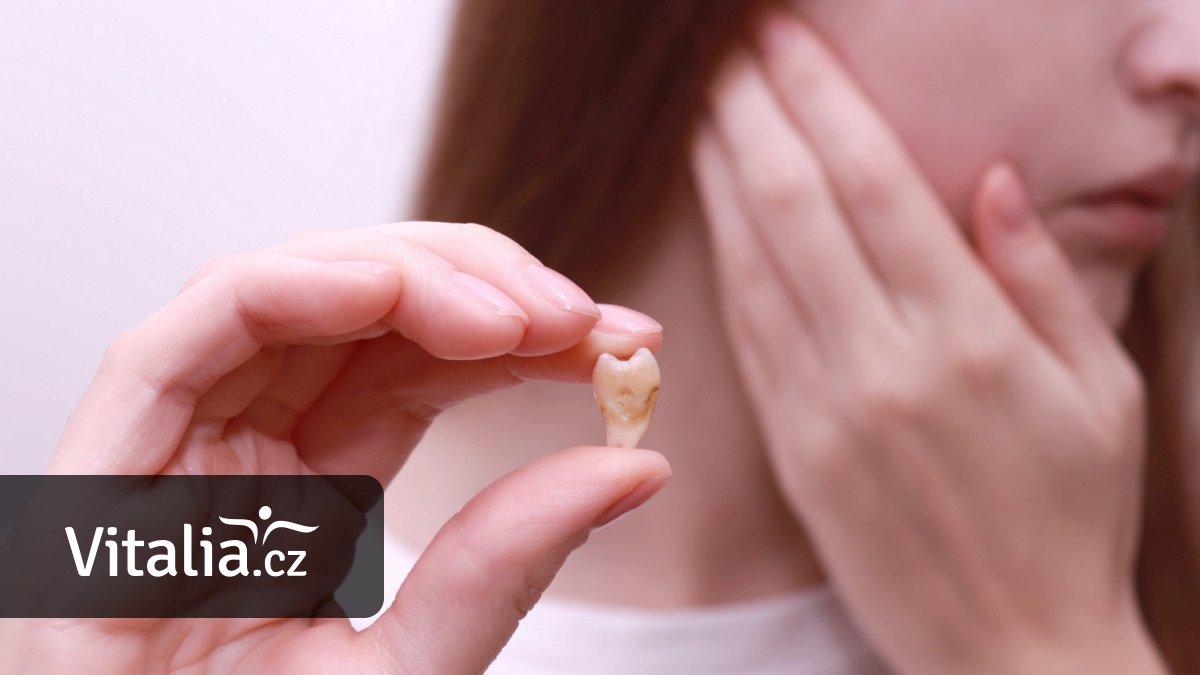 Osmičky vyndá jakýkoliv zubař, lepší je ale jít za specialistou. Nově si ho vyhledáte online