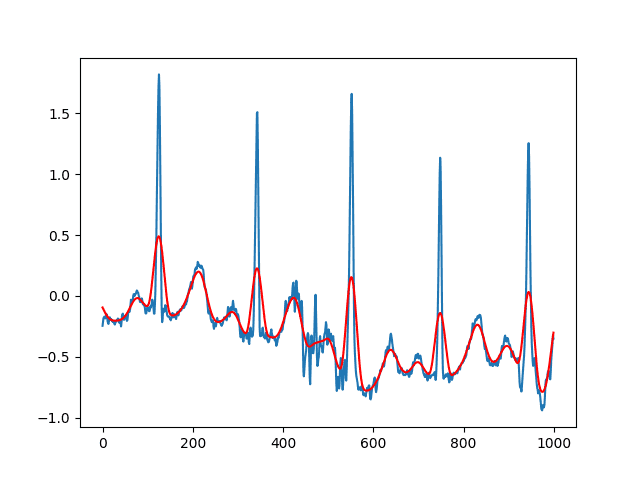 Konvoluce EKG s Hannovým oknem, zobrazení původního signálu i výsledku konvoluce