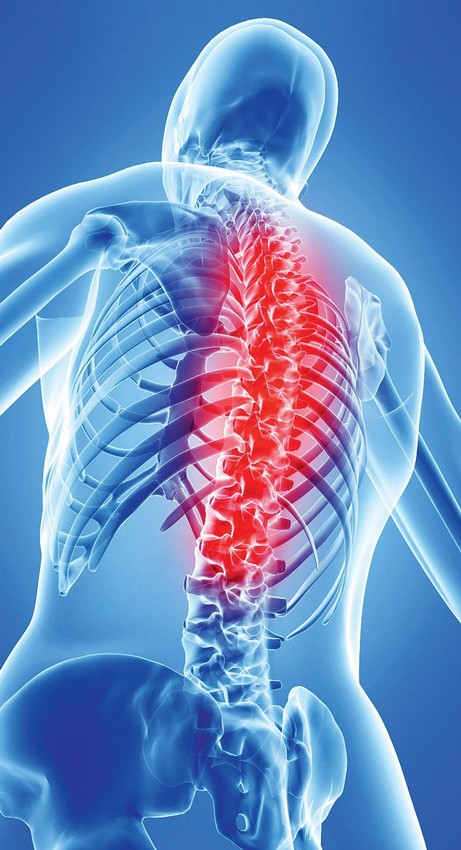 Ankylozující spondylitida z pohledu fyzioterapeuta