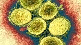 Náhledový obrázek - Vědci chtějí v laboratoři vytvořit kmen nové ptačí chřipky H7N9