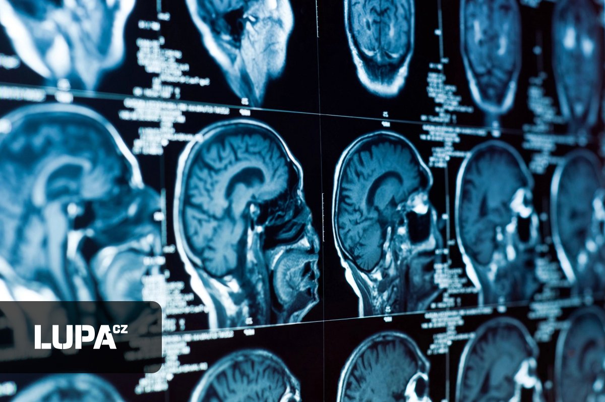 Ve většině nemocnic v Česku už se setkáte s AI. Její nasazení roste exponenciálně, hlásí zařízení