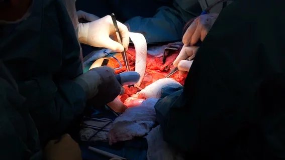 Pacient byl v IKEM hospitalizován s lokálním tumorem (desmoidem), který mu napadl většinu orgánů v dutině břišní, a i samotnou břišní stěnu tedy přední stranu břicha.
