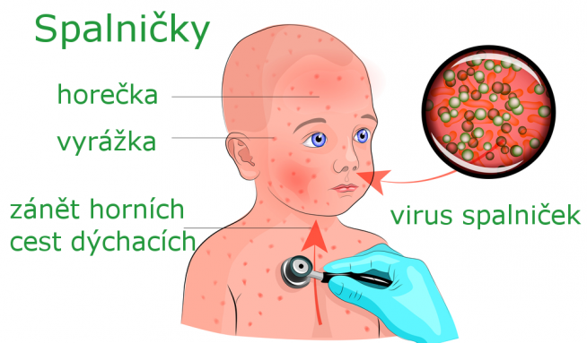 Autor: Depositphotos.com / Vitalia.cz