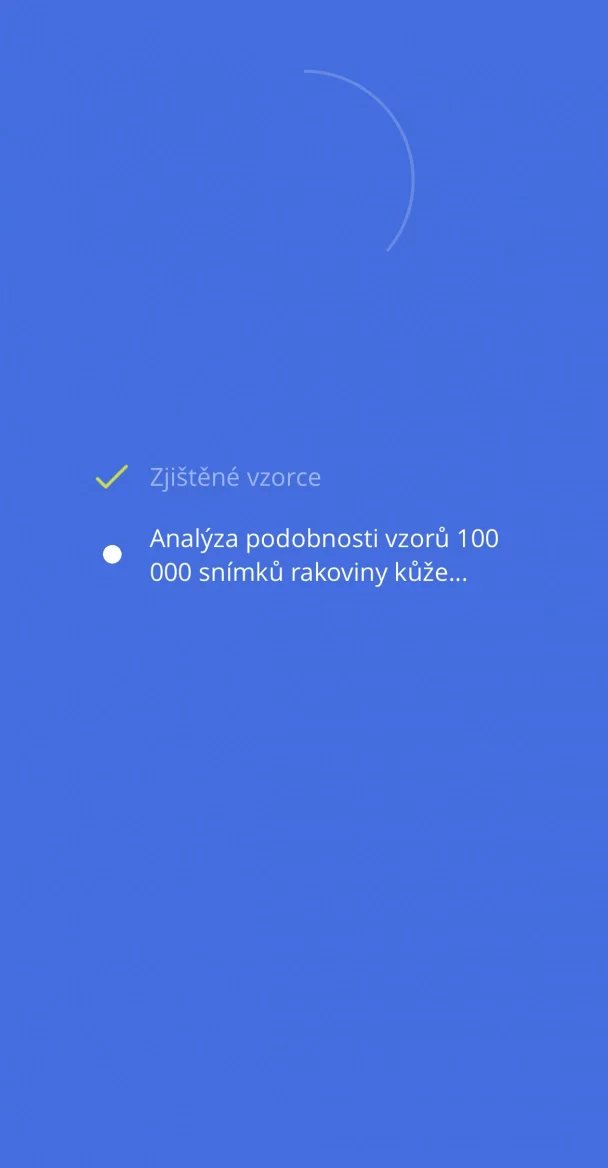 Porovnává ho se snímky až sta tisíc melanomů.