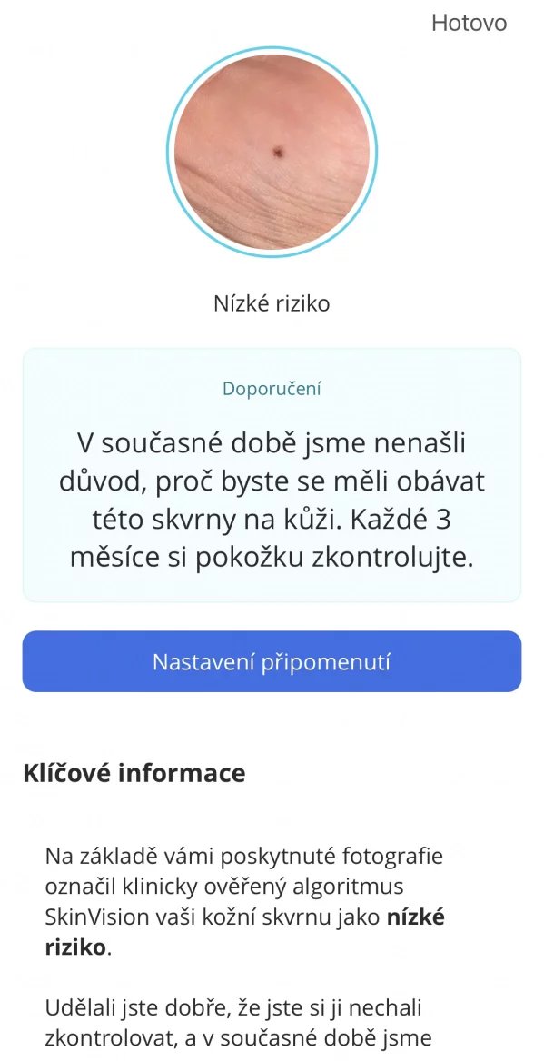 Výsledkem je vyhodnocení rizikovosti znaménka.
