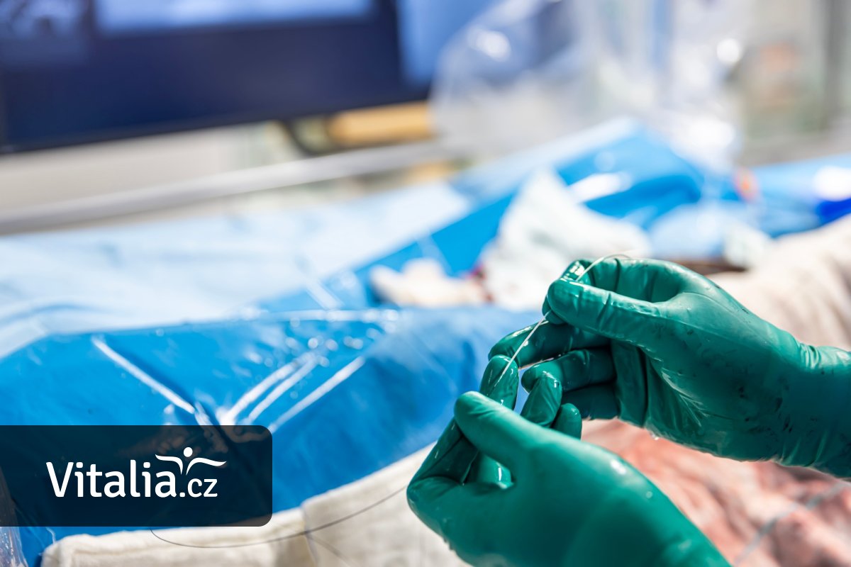 První katetrizace lidského srdce: Přes zákaz nadřízeného si lékař zavedl katetr do vlastní žíly