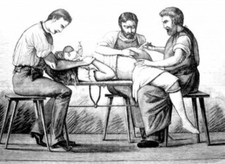 Historie gynekologie - operace, obrázek z roku 1896