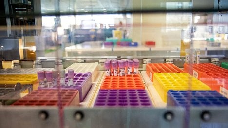 Putování krve: reportáž z laboratoře, kde zjišťují cukrovku nebo nemocná játra