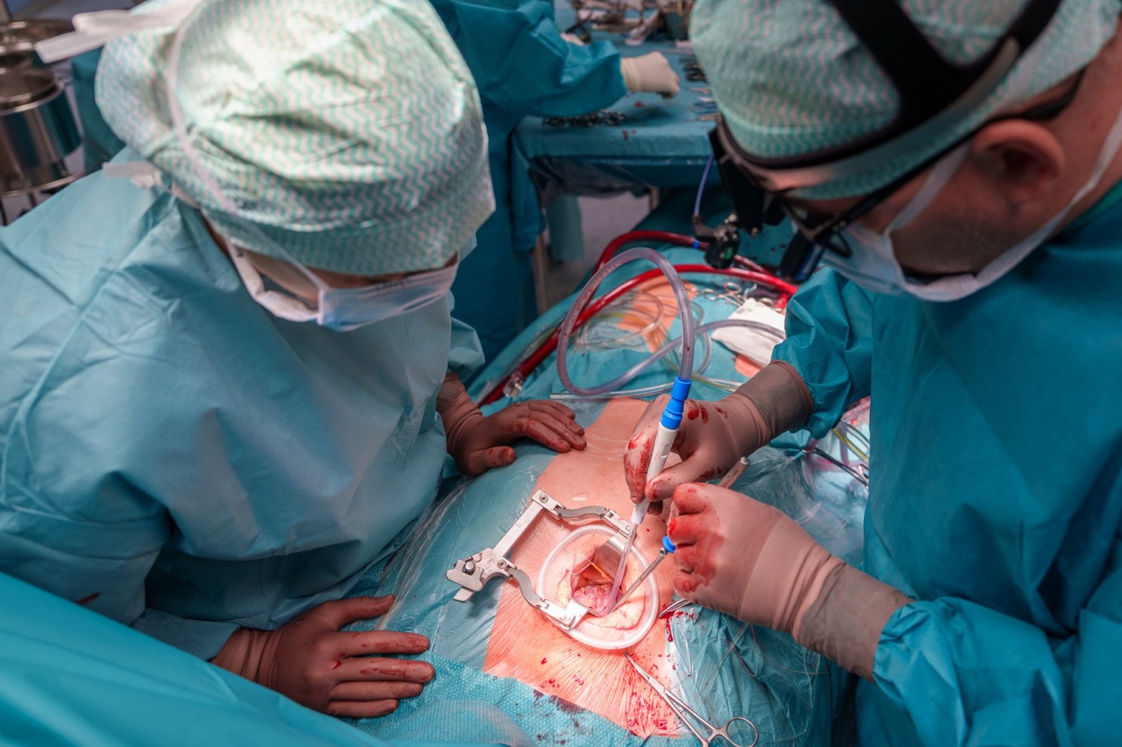 Lékaři z FN Olomouc operují chlopeň miniinvazivně