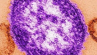 Náhledový obrázek - V Ústeckém kraji nepřibývá spalniček,epidemie by mohla odeznít