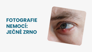 Náhledový obrázek - Ječné zrno foto: jak vypadá a v čem se liší od vlčího zrna?