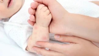 Náhledový obrázek - Sedmá dětská nemoc se netýká jen dětí. Může se vyskytovat i opakovaně