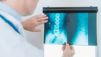 Náhledový obrázek - Osteomyelitida může být velice bolestivá. Dochází k ní následkem bakteriální infekce
