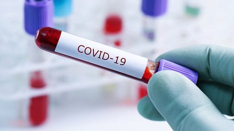 Náhledový obrázek - Pochází covid z laboratoře? Vědci z Wu-chanu onemocněli už na podzim 2019, naznačují USA