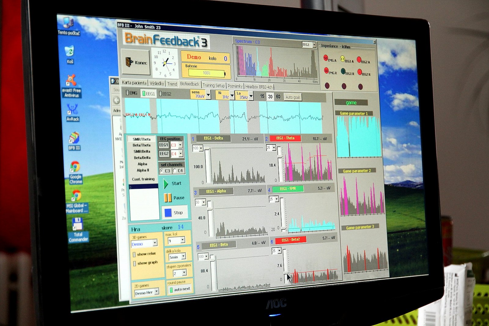 Biofeedback: mozek si hraje - a posiluje
