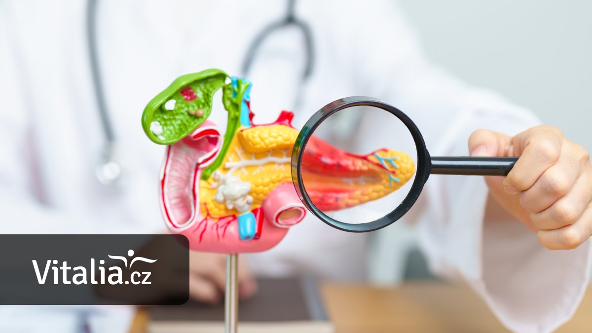 Jaká velikost nádoru slinivky dává šanci na přežití a které vyšetření ji odhalí včas