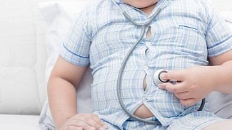 Náhledový obrázek - Praderův-Williho syndrom je nejčastější genetickou příčinou obezity. Jaké jsou jeho typické příznaky?