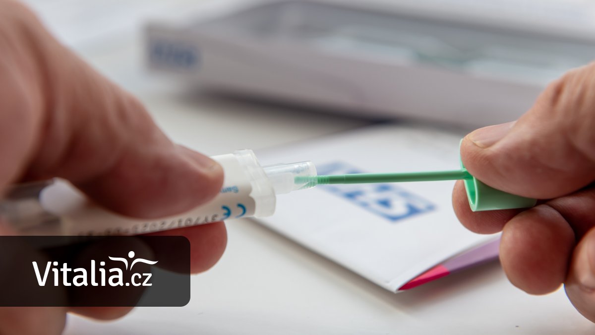 Preventivní test krvácení do stolice pojišťovny uhradí už jen jednou za dva roky