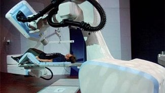 Náhledový obrázek - Ostravský CyberKnife lékaři poprvé použili na léčbu arytmie srdce