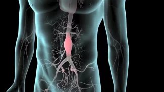 Zobrazení výdutě břišní aorty - aneurysma