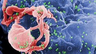 Náhledový obrázek - Američtí vědci hlásí posun při vyvíjení vakcíny proti AIDS