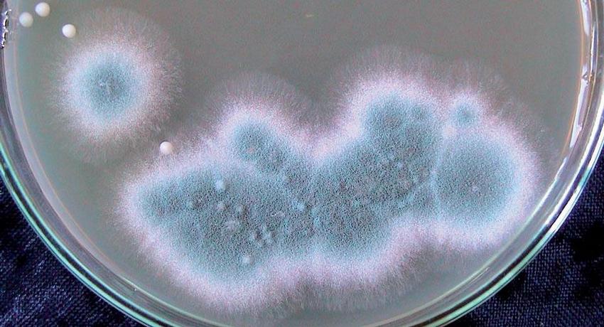 Obr. 4 – Růst A. fumigatus na SGA po 48 h při 37 °C (sputum)