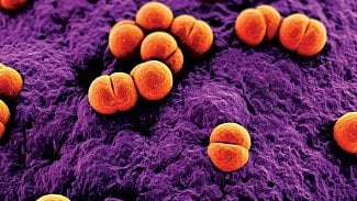 Náhledový obrázek - WHO: Mnohým africkým zemím hrozí epidemie smrtelné meningitidy