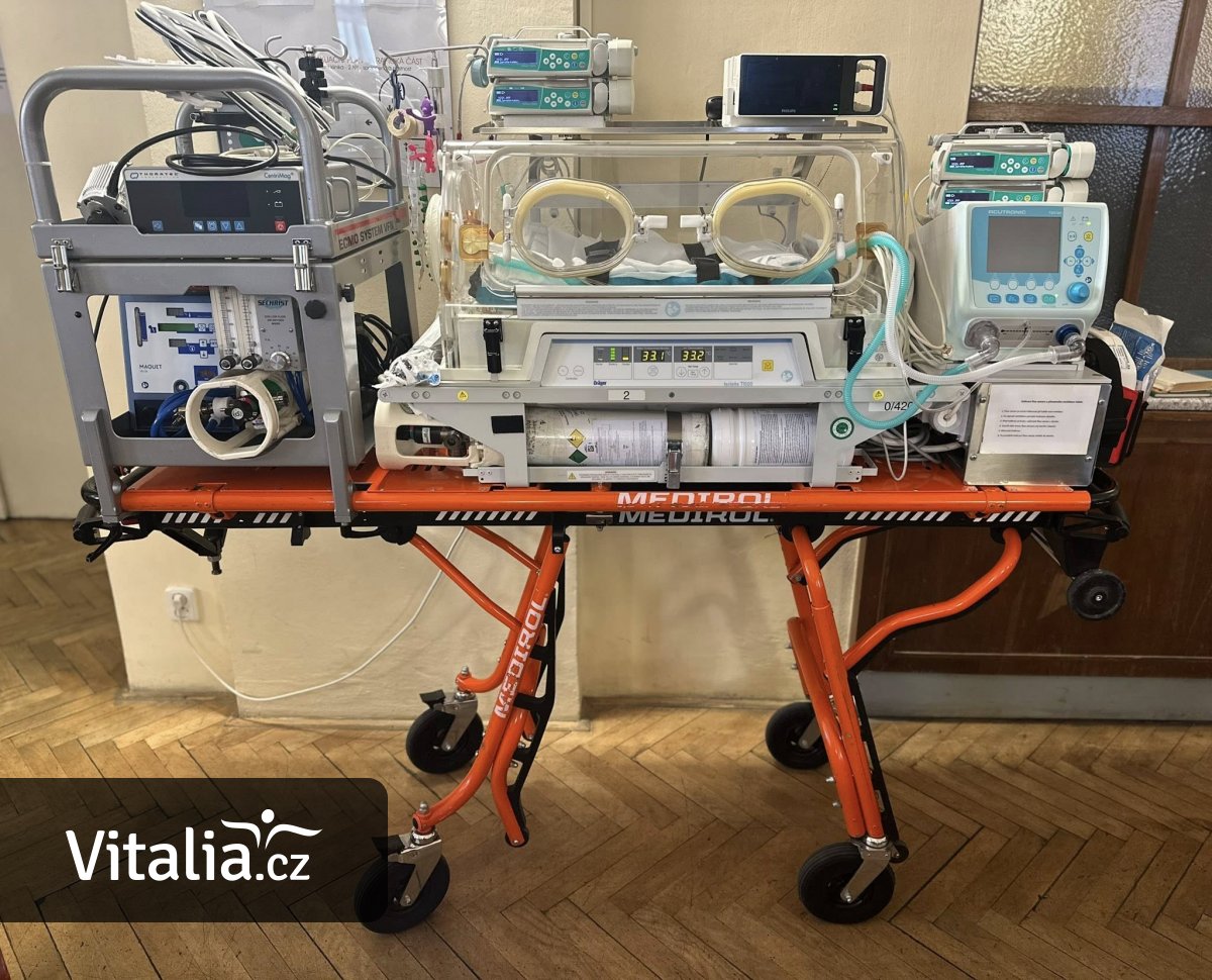 Kubík musel na mimotělní oběh hned po porodu. Dnes je úplně v pořádku