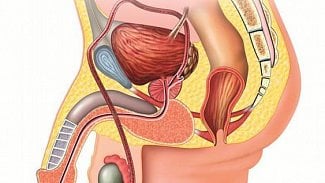 Náhledový obrázek - Rakoviny prostaty přibývá, čtvrtina se zjistí pozdě