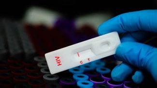 rychlotest hiv aids