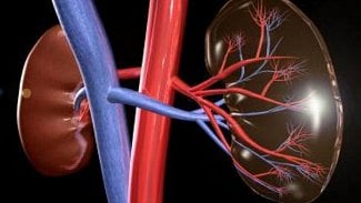 Náhledový obrázek - Poprvé v ČR odstranili lékaři v Motole ledvinu šetrnější cestou