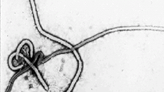 Náhledový obrázek - Ebola podle Světové banky postižené země srazí na kolena