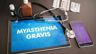 Náhledový obrázek - Myasthenia gravis způsobuje celkovou svalovou slabost. Jak se tento problém léčí?