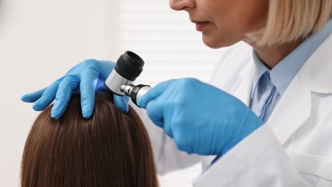 Vyšetření pokožky hlavy dermatoskopem