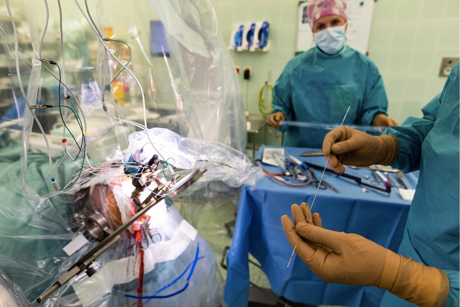 Pacienti jsou při vkládání elektrod při vědomí, operaci neurochirurgové provádí jen v lokálním znecitlivění. Potřebují totiž, aby s nimi pacient během zákroku komunikoval, což lékařům pomáhá při orientaci v mozku.