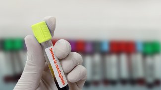 Náhledový obrázek - Až 50 procent úmrtí pacientů s meningokokovým onemocněním je do 24 hodin